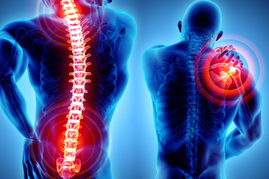 Pain Management